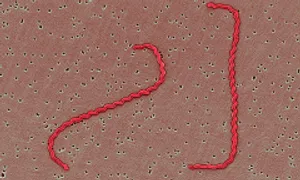 Suýt mất mạng do nhiễm xoắn khuẩn từ chuột